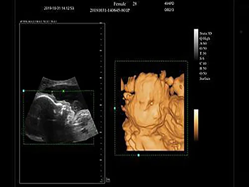 3D/4D-визуализация