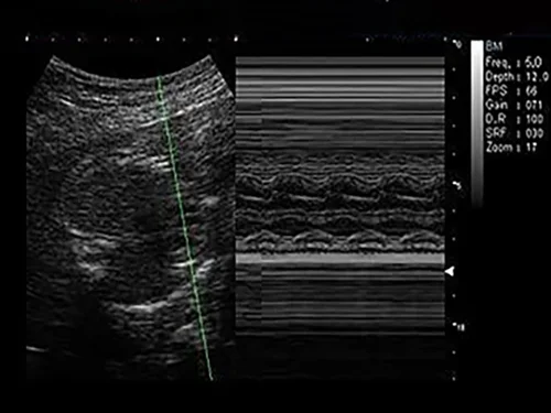 M-режим, анатомический M-режим
